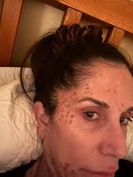 Anyone else think there needs to be more lighting by greenleys doctor  surgery. Walking down that little path to shops always think I'm gonna  jumped.🤦‍♂️😂 Cant see your hands in front of