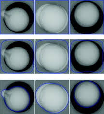 Schimbați din lei românești în euro utilizând convertorul nostru valutar. Automatic Nacre Thickness Measurement Of Tahitian Pearls Springerlink