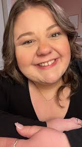 noticing that i'm losing weight in my face!! first pic is 2 years ago,  second pic is today! i'm 5 weeks post-op