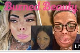 How this burn survivor turned tragedy into triumph by creating inspiring  makeup tutorials