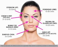 botox unit diagram botox injection sites forehead botox