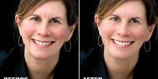 Portrait Photography