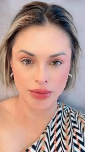 Não Faça Botox!!!!!, #estetica , #viral , #beleza