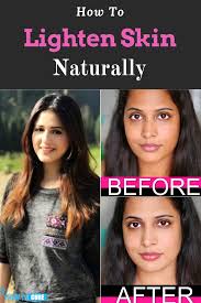 How To Lighten Skin Naturally Howtocure Natural Skin Lightening Brighten Skin Naturally Lighten Skin