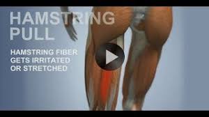 They can affect people across all kinds of sports and can be such a the good news is that just because you have a hamstring injury doesn't mean you have to give up. Hamstring Strain Physiopedia