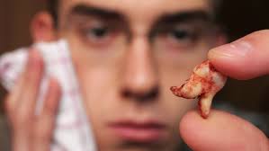 Du kannst folgendes essen : Frage Antwort Warum Haben Menschen Weisheitszahne N Tv De