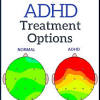 It is usually first children with adhd have trouble paying attention, controlling impulsive behaviors (may act without thinking. 1