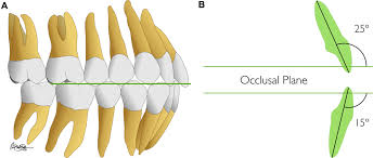 We did not find results for: Facial Versus Skeletal Landmarks For Anterior Posterior Diagnosis In Orthognathic Surgery And Orthodontics Are They The Same Journal Of Oral And Maxillofacial Surgery