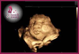 3d ultraschall kussi 4d ultrasound ultrasound pics