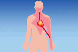 Image result for Chest Pain