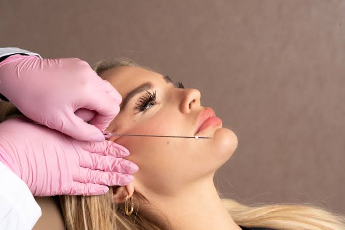 What Are the Primary Benefits of PDO Thread Lift for Individuals Seeking  Non-Surgical Facial Rejuvenation? - Beauty Boost Med Spa