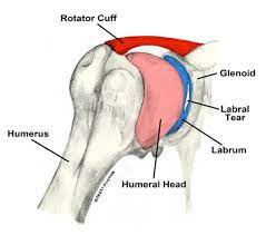 I've just switched over to this diagram here and we're looking at the same view, a lateral view of the right shoulder. Torn Shoulder Labrum Causes Symptoms Treatment Recovery