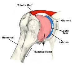 The labrum is a ring of soft fibrous tissue that surrounds the glenoid (the end of the shoulder blade) and helps stabilize the shoulder joint. Torn Shoulder Labrum Causes Symptoms Treatment Recovery