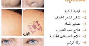 استخدمات جهاز الليزر سبكترا Vrm الرياض ٠١١٢٦٣٢٤٢٤ Pnu Pnucs كلام اول مره تقوله بنوتات Paw Print Tattoo Print Tattoos Paw Print