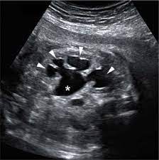Genitourinary Tract Radiology Key