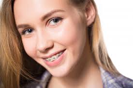 Stephen dickey and his amazing team at total dental care offers teeth whitening, dental implant restorations. Orthognathic Surgery In Peoria Pekin Corrective Jaw Surgery