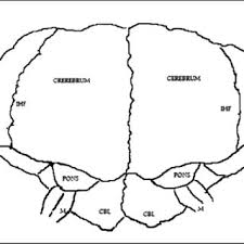 Ladan und laleh seien eine quelle der inspiration für alle menschen um sie herum gewesen. Pdf Craniopagus Laleh And Ladan Twins Sagital Sinus