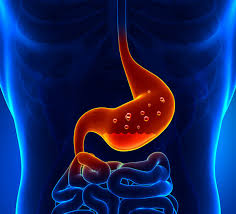 It happens when stomach contents flow back up (reflux) into the food pipe (esophagus). Gerd Los Angeles Integrative Gastroenterology Nutrition