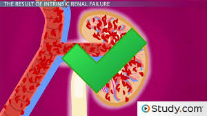• management priorities in patients with acute renal failure search for and correct prerenal and postrenal factors. Acute Renal Failure Intrinsic Renal Failure Its Consequences Video Lesson Transcript Study Com