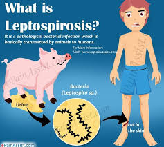 Isteri syukri, siti nurfatihah ahmad adnan terpaksa ditahan dalam wad sebuah hospital swasta di ibu kota apabila disahkan dijangkiti virus leptospirosis atau kencing tikus. Leptospirosis Penyebab Gejala Rawatan Pencegahan A To Z Panduan 2021