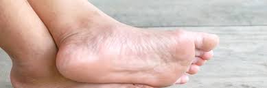 Stopa cukrzycowa to zakażenie, owrzodzenie lub zniszczenie tkanek głębokich stopy. Wspomaganie Leczenia Stopy Cukrzycowej Help4skin