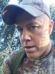 Hunting Separation Anxiety Part II: "The Transylvanian Roar"