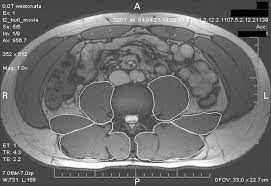 Below you can see all the major back muscle. Mri Study Of The Size Symmetry And Function Of The Trunk Muscles Among Elite Cricketers With And Without Low Back Pain British Journal Of Sports Medicine