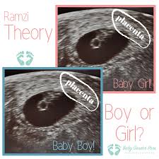 Pin On Baby Gender Prediction