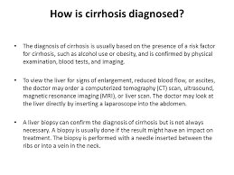 We'd also like to use analytics cookies. Liver Cirrhosis S Diana Garcia Ppt Video Online Download
