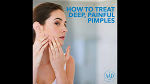 Share your videos with friends, family, and the world How To Treat A Deep Painful Pimple Youtube