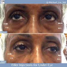 Michael Lin, M.D. (@michael_lin_md) • Instagram photos and videos