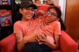 Conjoined Twin Carmen Andrade Has Quietly Married Boyfriend Daniel McCormack