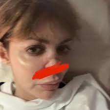 «вот одни из моих самых дорогих фото. Foto V Bolnice Byvshaya Zhena Andreya Arshavina Pokazala Izurodovannoe Boleznyu Lico