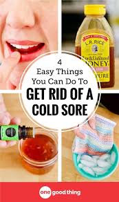 Confused About Cold Sores Learn What They Are What Causes Them And Find Out About Simple And Natural Wa Cold Sores Remedies Cold Sore Natural Cough Remedies