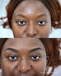 💥Models Needed for New Visuals at HEAVILY DISCOUNTED rate. Models will be  performed in private by myself with no students present.💥 Would like  Models to have: 📌Normal/dry skin types (please no large