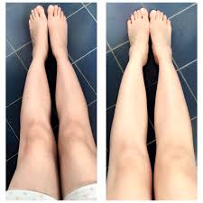 How To Get Rid Of Dark Elbows Knees And Armpits Coconut oil can help with hemorrhoids. how to get rid of dark elbows knees