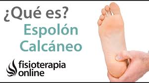 Check spelling or type a new query. Que Es El Espolon Calcaneo Youtube