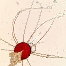 Image result for Uncinula necator