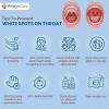 Jun 17, 2018 · white spots on your tonsils are usually caused by a viral or bacterial infection. 3