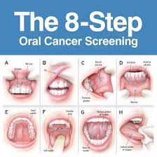 Image result for gum cancer symptoms