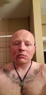 I'm new to this group, is this a safe space to talk about beard health?