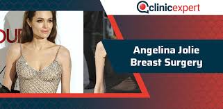 The actress has never confirmed that she's gotten a nose job, but multiple plastic surgeons have said that it looks like she's had a rhinoplasty . Angelina Jolie Breast Surgery Clinicexpert International Healthcare