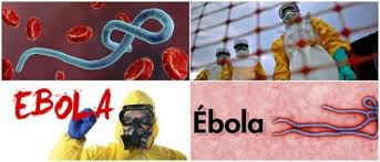 Maybe you would like to learn more about one of these? Ebola Causas Factores De Riesgo Complicaciones Sintomas Diagnostico Tratamiento Y Prevencion Arriba Salud