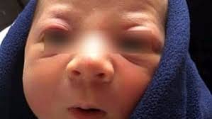 Neonato muore di meningite a 3 settimane, i genitori: "Non aveva nessun  sintomo"