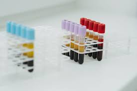 Meine frage ist, ob ich irgendwas riskieren, wenn ich zu hause den entzug mache. Amphetamin Entzug Zuhause Ablauf Dauer Symptome Von Amphetamin