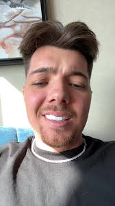 Are my teeth too white!?