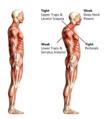 Pin On Rounded Shoulder Syndrome