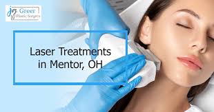 Laser Treatments in Mentor, OH