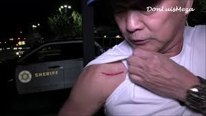 During the trip, Carrington, without provocation, struck the first victim,  breaking his jaw, rendering him unconscious. Carrington then retrieved a  rifle,,,