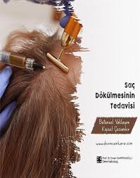 Topikal Minoksidil Losyon Agi Sac Sampuan Sac Dokulmesi